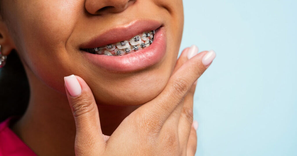 Braces of a women